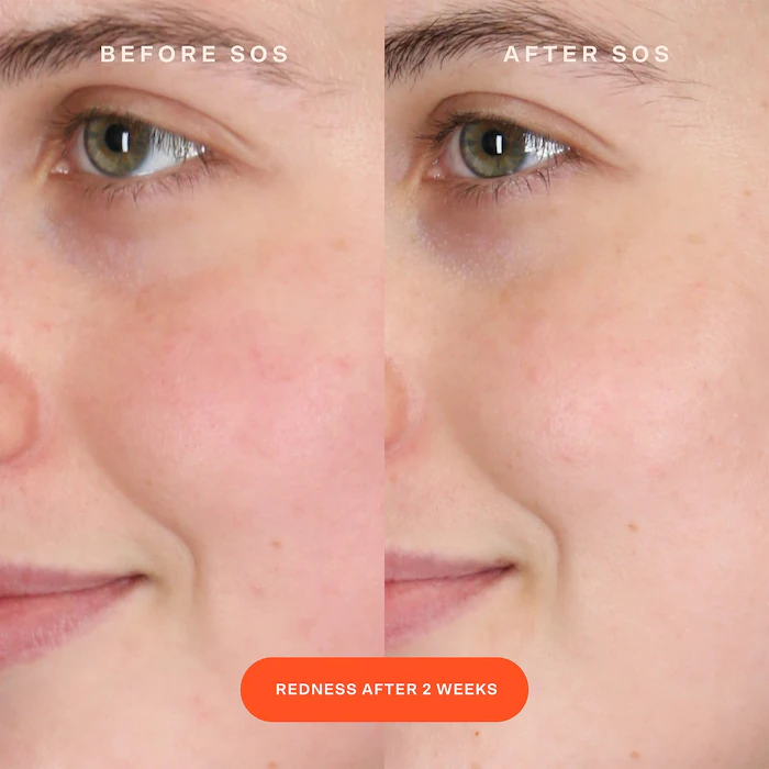 SOS Intensive Redness Relief Serum - Image 9